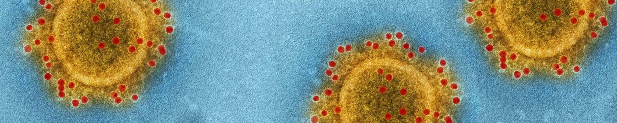 Virus microscopie COCOTS