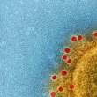 Virus microscopie COCOTS